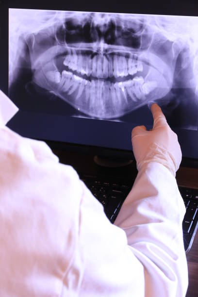 Best Emergency Dental Care for Abscessed Tooth in Linden, MI