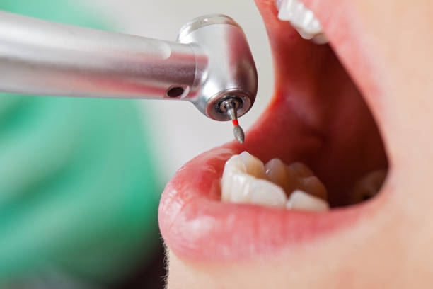 Best Broken or Cracked Tooth Emergency Dentist in Linden, MI